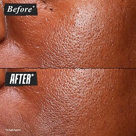 Pure Serum 5% Niacinamide